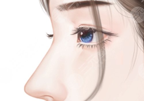 西安何林做的雙眼皮