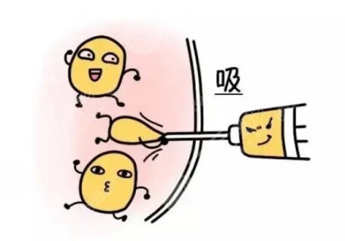 范希玲一天排幾個手術(shù)