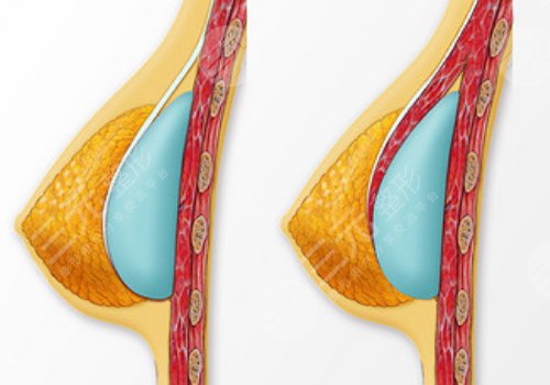 范希玲一天排幾個手術(shù)