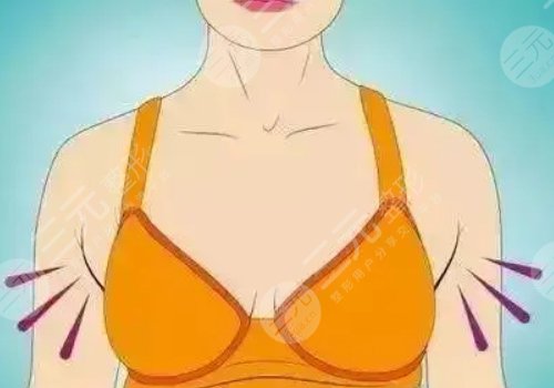 上海九院隆胸專家排名 