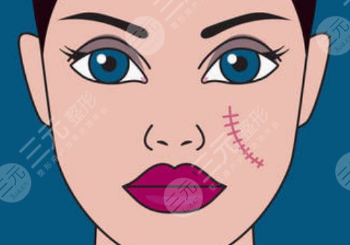 汕頭紫齡醫(yī)療美容門(mén)診部祛疤怎么樣