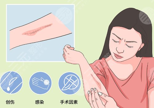 汕頭萊美醫(yī)療美容門診部祛疤怎么樣