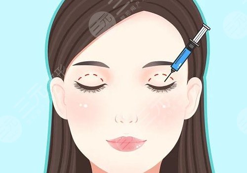 西安李學(xué)擁雙眼皮割的好嗎