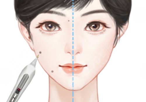 汕頭市中心醫(yī)院美容科 點(diǎn)痣怎么預(yù)約