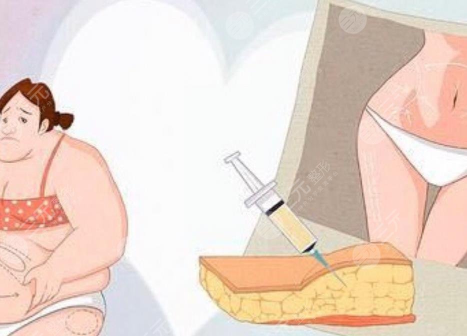 蘭州軍區(qū)陸軍總院整形美容中心吸脂瘦大腿案例