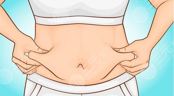 腰腹吸脂