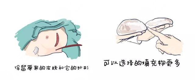 天水407醫(yī)院整形美容科隆胸案例