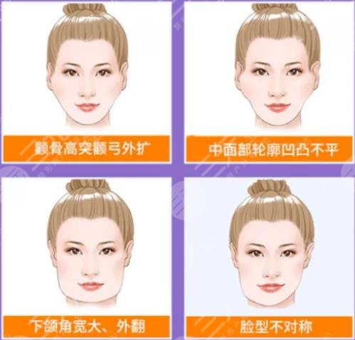 顴骨磨骨手術(shù)過程科普！頜面整形不簡(jiǎn)單，術(shù)前知識(shí)點(diǎn)掃盲！