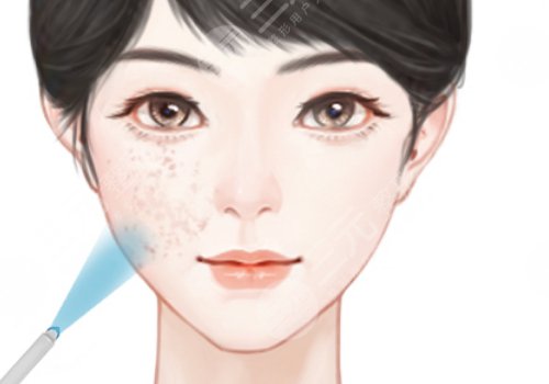 做醫(yī)美多少錢一個(gè)月