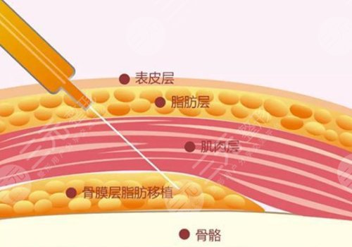 整容下巴多少錢