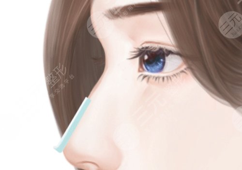 做鼻子耳軟骨好還是肋骨好