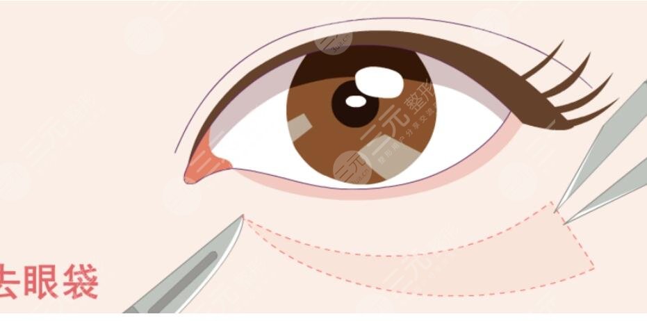 去眼袋