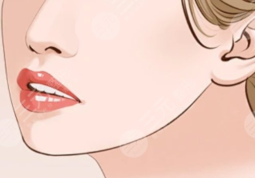 下顎線整形多少錢