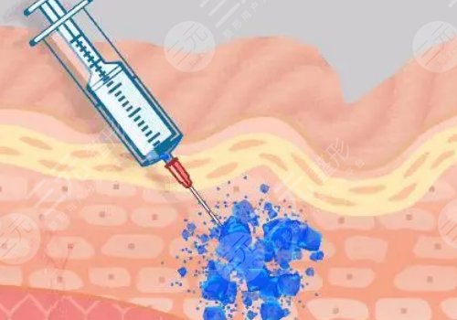 汕頭汕美醫(yī)療美容醫(yī)院是三甲么