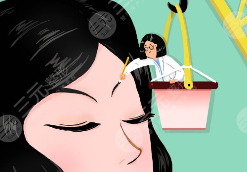 雙眼皮下垂怎么解決