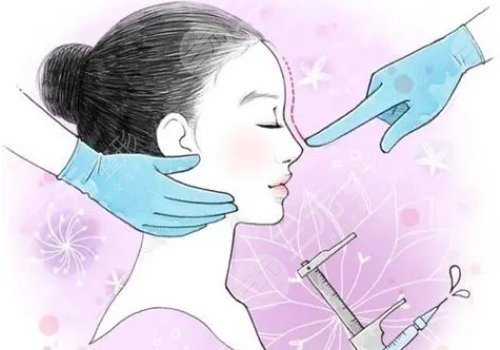 鼻子縮小整形手術(shù)