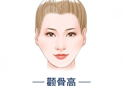 顴骨手術(shù)費(fèi)用一般多少