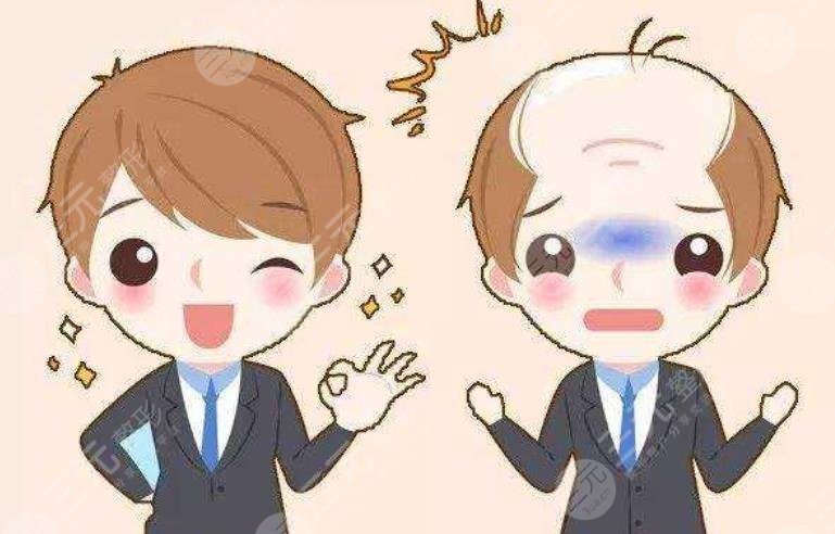 發(fā)際線種植術(shù)前注意