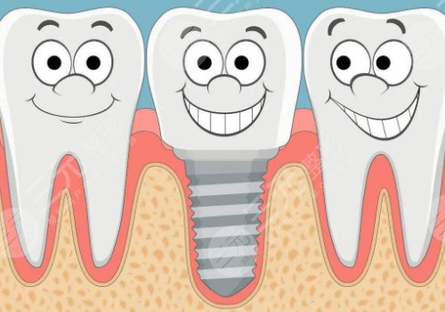 黃丞蔚種牙多久了