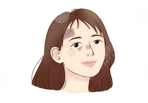 汕頭萊美醫(yī)療美容門診部祛斑怎么樣