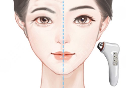 醫(yī)美超聲刀多少錢一次