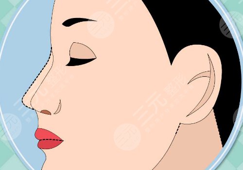 　佛山美萊醫(yī)療美容醫(yī)院吸脂價(jià)格