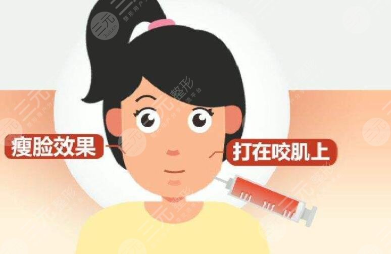 注射瘦臉