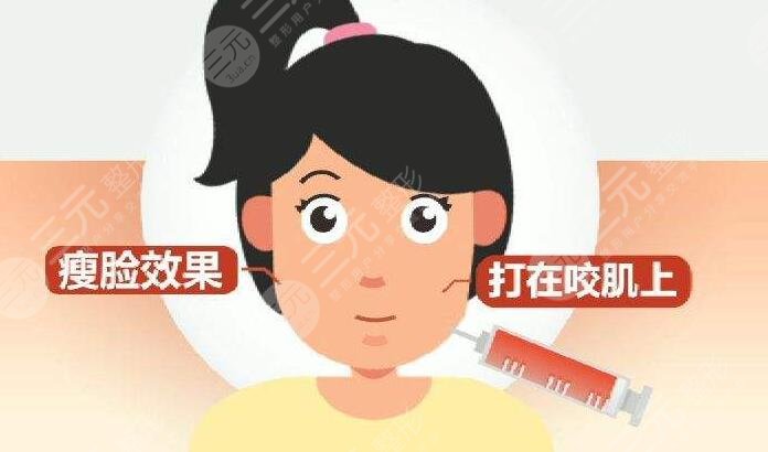 注射瘦臉