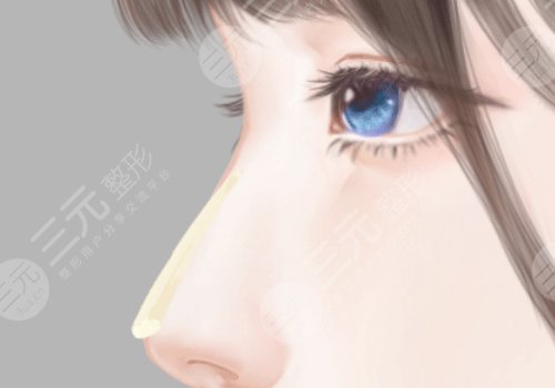 肋骨鼻多少錢(qián)