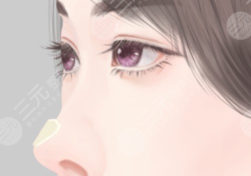 肋骨鼻多少錢(qián)