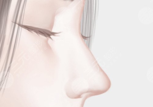 肋骨鼻多少錢(qián)