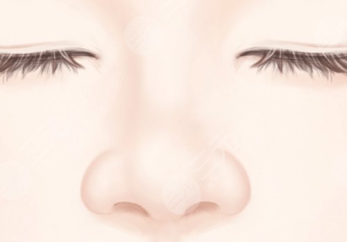 王金明醫(yī)生割雙眼皮