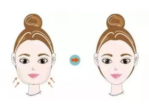 下頜骨整形術(shù)一般費(fèi)用