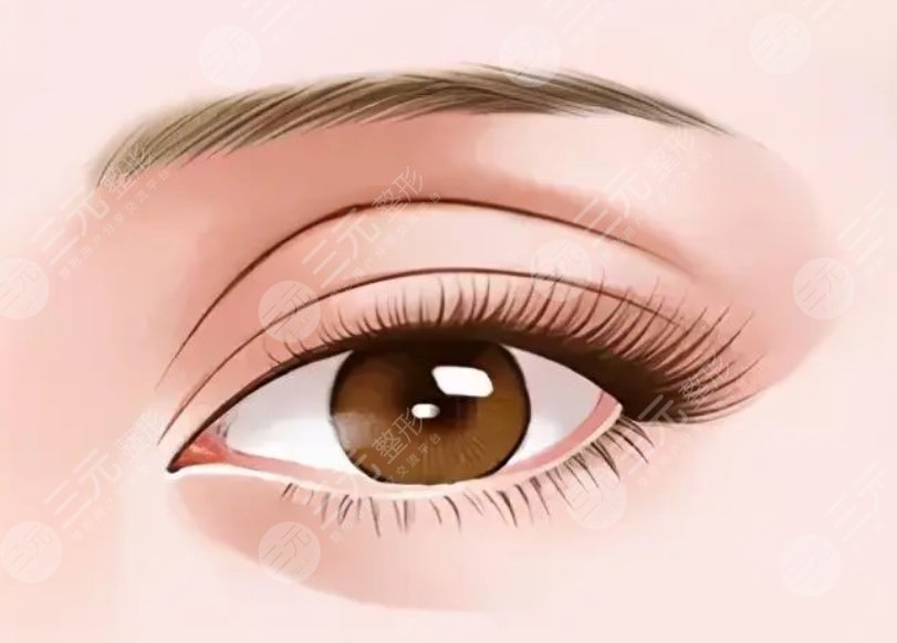 雙眼皮項(xiàng)目