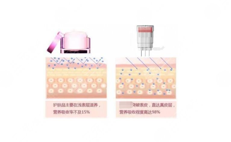 英諾水光多久有效