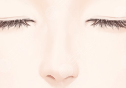 肋骨鼻一個月定型了嗎