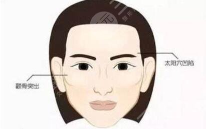 豐太陽(yáng)穴