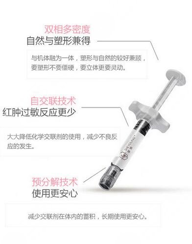 馨妍玻尿酸屬于什么檔次