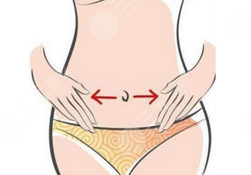 吸脂瘦腰方法怎么樣