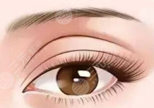 雙眼皮脂肪去多了凹陷怎樣修復(fù)