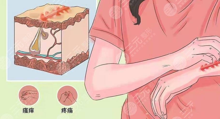 上海地區(qū)疤痕修復(fù)價(jià)格明細(xì)表