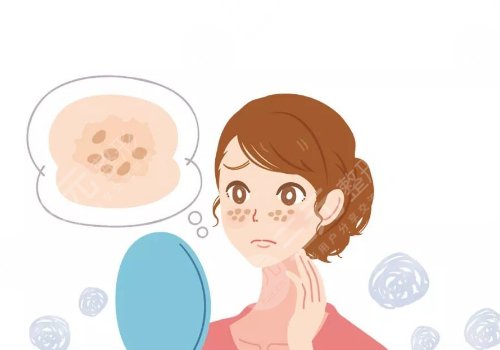 e光整形美容嫩膚祛斑