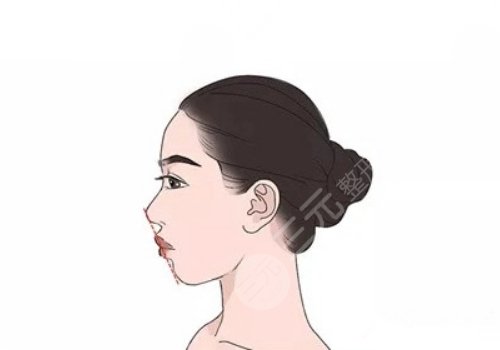 下頜骨歪斜怎么矯正