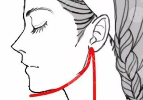 左右下頜骨不對稱怎么矯正