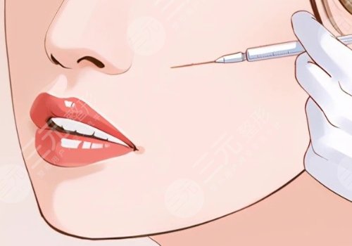 面頰填充用什么填充比較好