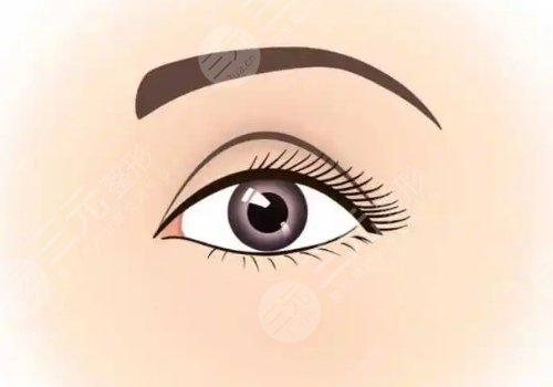 埋線雙眼皮一個(gè)寬一個(gè)窄怎么修復(fù)