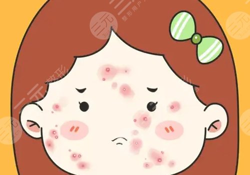 四會(huì)紫盈美容院去痘坑怎么樣