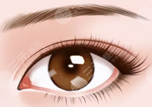 雙眼皮修復(fù)的價格