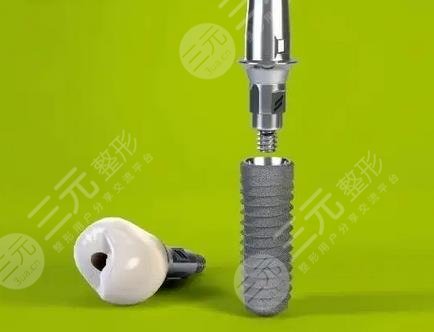 南京(江蘇)省人民醫(yī)院種植牙收費標準