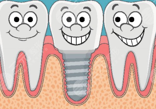 蘇大附一院看牙怎么樣